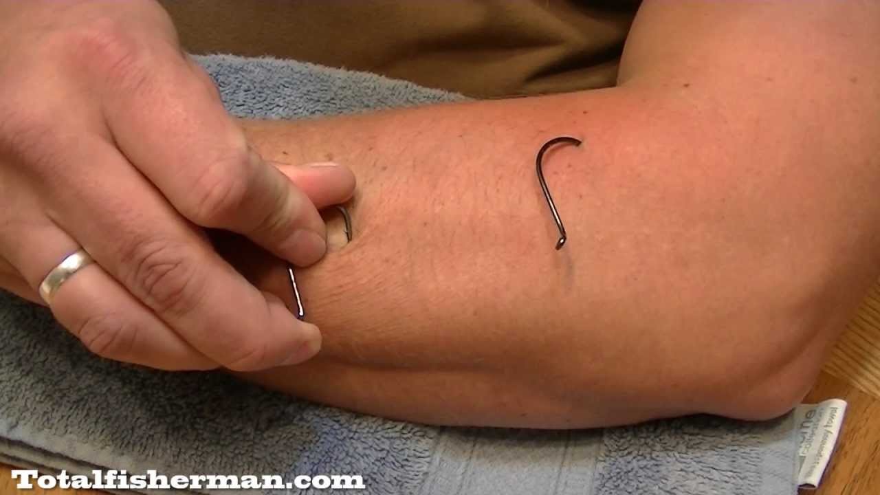 Fishing Guide Removes 4 Hooks From His OWN Arm to Teach Us How